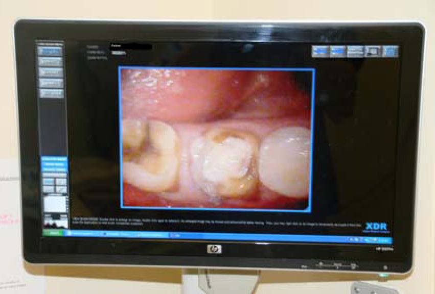 IntraOral Camera John F. Conaghan, DDS